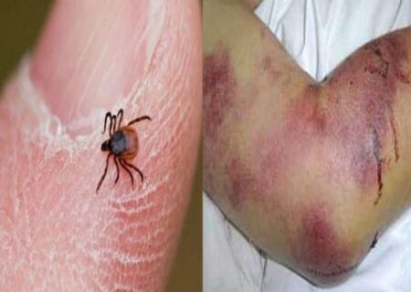 افزایش مبتلایان تب کریمه کنگو به ۶۳ نفر/ لزوم تشدید مراقبت‌ها در مشاغل مرتبط با دام