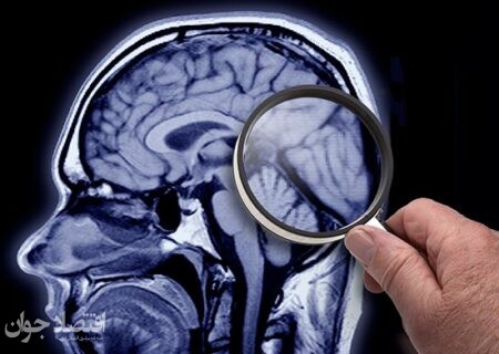 رژیم غذایی که نشانه‌های زوال عقل را کاهش می‌دهد