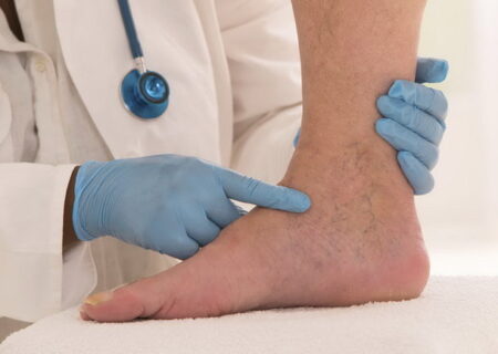 چه خطری مچ پای ورزشکاران را تهدید می‌کند؟