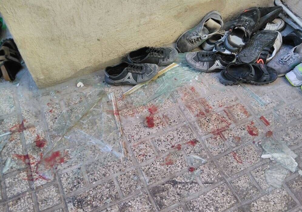 وخامت حال مصدومان قوام‌الدوله؛ مرد افغانی اعتراف کرد!